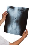 New Research on Importance of X-rays in Chiropractic Practice 