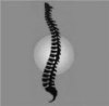 Perle & Barrett Attack Subluxation Based Chiropractic Perle & Barrett Attack Subluxation Based Chiropractic