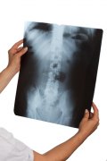 New Research on Importance of X-rays in Chiropractic Practice New Research on Importance of X-rays in Chiropractic Practice