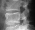The Necessity for X-Ray Examination in Chiropractic, It’s Time to Accept the Evidence. The Necessity for X-Ray Examination in Chiropractic, It’s Time to Accept the Evidence.