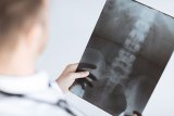 New Research Sheds Light on X-Ray Guidelines in Chiropractic New Research Sheds Light on X-Ray Guidelines in Chiropractic