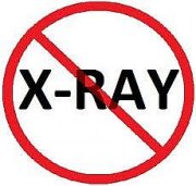British Columbia Bans X-Rays for Vertebral Subluxation Assessment
