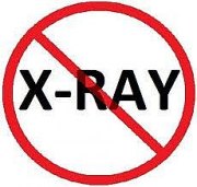 British Columbia Bans X-Rays for Vertebral Subluxation Assessment British Columbia Bans X-Rays for Vertebral Subluxation Assessment