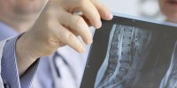 New Research on Importance of X-Rays in Chiropractic New Research on Importance of X-Rays in Chiropractic