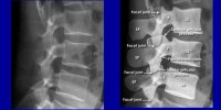 IFCO Response to Proposed Irish Legislation Regarding X-ray IFCO Response to Proposed Irish Legislation Regarding X-ray