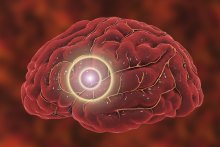 RISK MANAGEMENT MINUTE – A Critical Look at Upper Cervical Adjusting Techniques and the Importance of Diligent Care RISK MANAGEMENT MINUTE – A Critical Look at Upper Cervical Adjusting Techniques and the Importance of Diligent Care