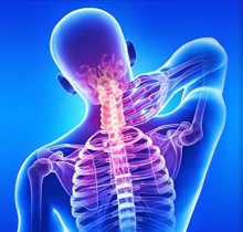 Understanding Cervical Spine Movement and Motor Vehicle Accidents Understanding Cervical Spine Movement and Motor Vehicle Accidents